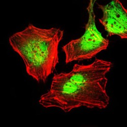 Keratin, Type II Cytoskeletal 5 (KRT5) Antibody