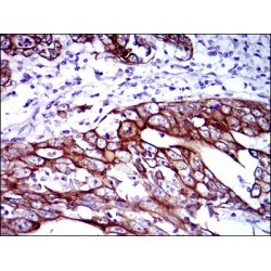 Keratin, Type II Cytoskeletal 5 (KRT5) Antibody