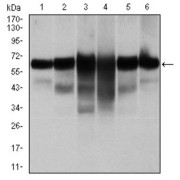 Western blot analysis using CK5 antibody against human CK5 (AA: 158-272) recombinant protein. (Expected MW is 33.3 kDa).