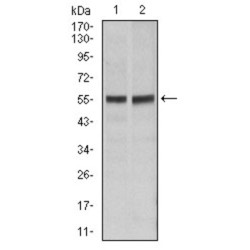 TNF Receptor Superfamily Member 6 / CD95 / TNFRSF6 (FAS) Antibody