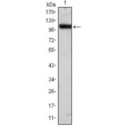 Western blot analysis using TLR2 antibody against Hela (1) cell lysate.