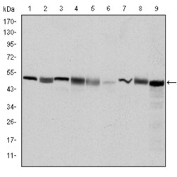 T-Complex Protein 1 Subunit Beta (CCT2) Antibody