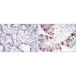 G2/mitotic-Specific Cyclin-B1 (CCNB1) Antibody