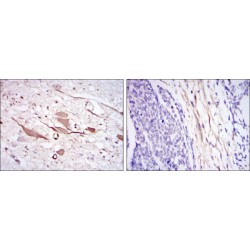 Heat Shock Protein 27 (HSP27) Antibody