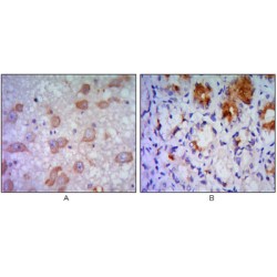 Endoplasmic Reticulum To Nucleus Signalling 1 (ERN1) Antibody