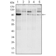 Western blot analysis using ERN1 antibody against Raji (1), A431 (2), Jurkat (3), Hela (4) and HEK293 (5) cell lysate.