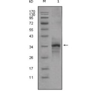 Western blot analysis using Myostatin antibody against truncated Myostatin-His recombinant protein (1).