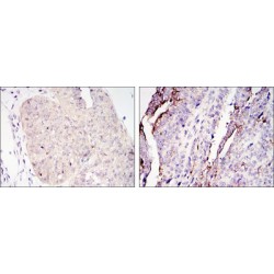 CREB-Regulated Transcription Coactivator 2 (CRTC2) Antibody