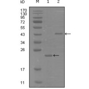 Western blot analysis using EphA8 antibody against truncated Trx-EphA8 recombinant protein (1) and truncated MBP-EphA8 (aa70-150) recombinant protein (2).