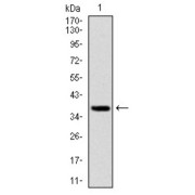 Western blot analysis using FOXO1 antibody against human FOXO1 (AA: 471-600) recombinant protein. (Expected MW is 39.3 kDa).