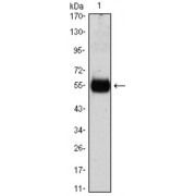 Western blot analysis using CDKN1B antibody against CDKN1B (AA: 1-198) -hIgGFc transfected HEK293 cell lysate.