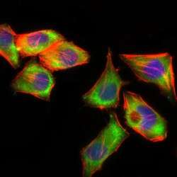 Prosaposin (PSAP) Antibody