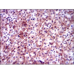 Prosaposin (PSAP) Antibody