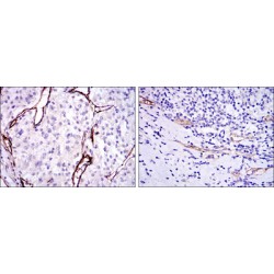 Endoglin / CD105 (ENG) Antibody