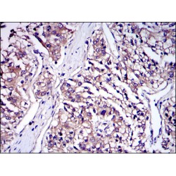 Interleukin 1 Receptor Associated Kinase 4 (IRAK4) Antibody