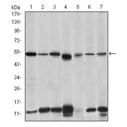 Interleukin 1 Receptor Associated Kinase 4 (IRAK4) Antibody