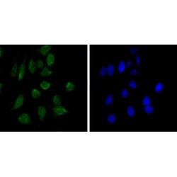 Chromodomain Helicase DNA Binding Protein 3 (CHD3) Antibody