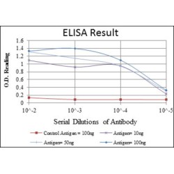 Eukaryotic Translation Elongation Factor 2 (EEF2) Antibody