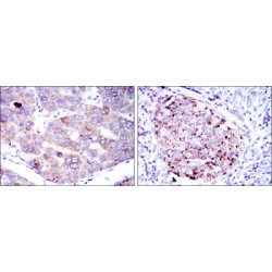 Eukaryotic Translation Elongation Factor 2 (EEF2) Antibody