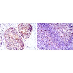 Eukaryotic Translation Elongation Factor 2 (EEF2) Antibody