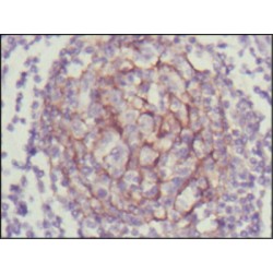 Neurotrophic Tyrosine Kinase Receptor Type 3 (NTRK3) Antibody