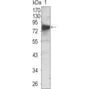 Western blot analysis using NTRK3 antibody against extracellular domain of human NTRK3 (32-429 AA).