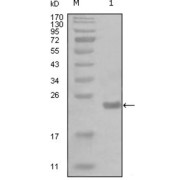 Western blot analysis using CHUK antibody against truncated Trx-CHUK recombinant protein (1).