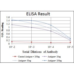 Podocalyxin (PODXL) Antibody