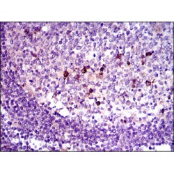 Transforming Growth Factor Beta 1 (TGFb1) Antibody