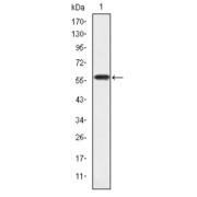 Western blot analysis using CRKL antibody against human CRKL (AA: 100-303) recombinant protein. (Expected MW is 60 kDa).