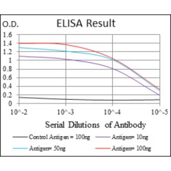 Rho-Associated Protein Kinase 1 (ROCK1) Antibody