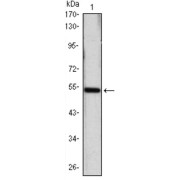 Western blot analysis using SHH antibody against SHH (AA: 26-161) -hIgGFc transfected HEK293 cell lysate.