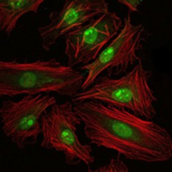 cAMP Responsive Element Binding Protein 1 (CREB1) Antibody