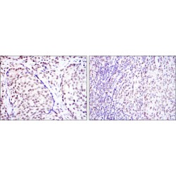 cAMP Responsive Element Binding Protein 1 (CREB1) Antibody