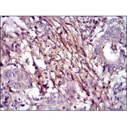 Fibronectin (FN1) Antibody