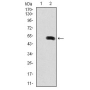 Western blot analysis using FN1 antibody against human FN1 (AA: 1965-2176) recombinant protein. (Expected MW is 49.6 kDa).