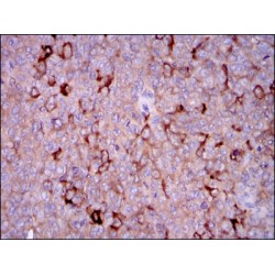 Glucose-6-Phosphate Dehydrogenase (G6PD) Antibody