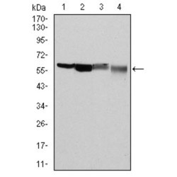 Glucose-6-Phosphate Dehydrogenase (G6PD) Antibody