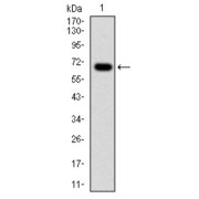 Western blot analysis using G6PD antibody against human G6PD (AA: 275-515) recombinant protein. (Expected MW is 53.1 kDa).