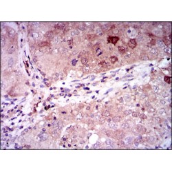 Gamma-Enolase (ENO2) Antibody