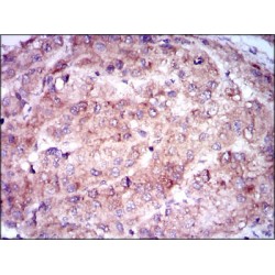 Gamma-Enolase (ENO2) Antibody