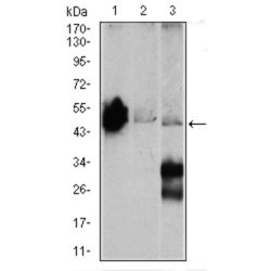 Gamma-Enolase (ENO2) Antibody