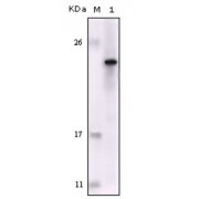 Western blot analysis using FES antibody against truncated FES recombinant protein.