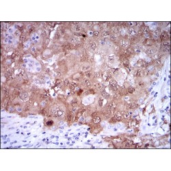 Cyclin-Dependent Kinase Inhibitor 2A (CDKN2A) Antibody