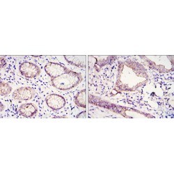 Cadherin-1 / E-Cadherin (CDH1) Antibody