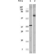 Western blot analysis using ELK1 antibody against truncated ELK1 recombinant protein (1) and K562 cell lysate (2).