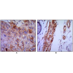 Vascular Cell Adhesion Molecule 1 (VCAM1) Antibody