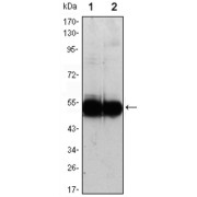 Western blot analysis using VCAM1 antibody against HUVEC (1) and EC (2) cell lysate.