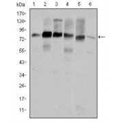 Western blot analysis using CTTN antibody against Hela (1), A431 (2), MCF-7 (3), SR-BR-3 (4), HepG2 (5) and NIH/3T3 (6) cell lysate.