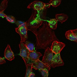 Apolipoprotein B (ApoB) Antibody